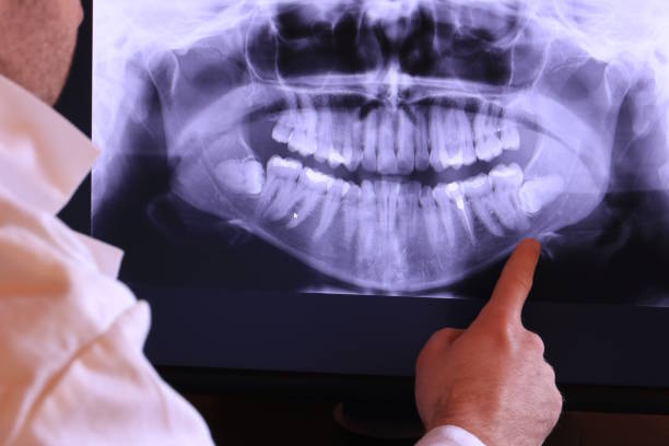 Best Weekend Emergency Dentist in Merkel, TX