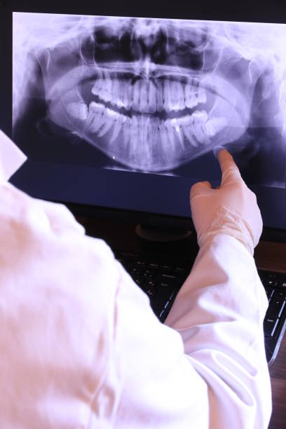 Best Emergency Dental Care for Broken or Chipped Teeth in Merkel, TX