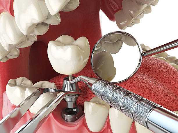 Best Same-Day Emergency Dental Services in Merkel, TX