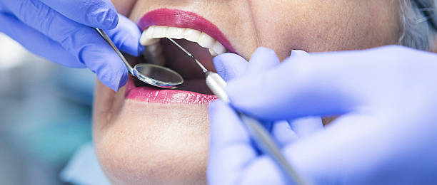 Best Emergency Gum Treatment in Merkel, TX